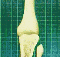 1609146925130314.gif